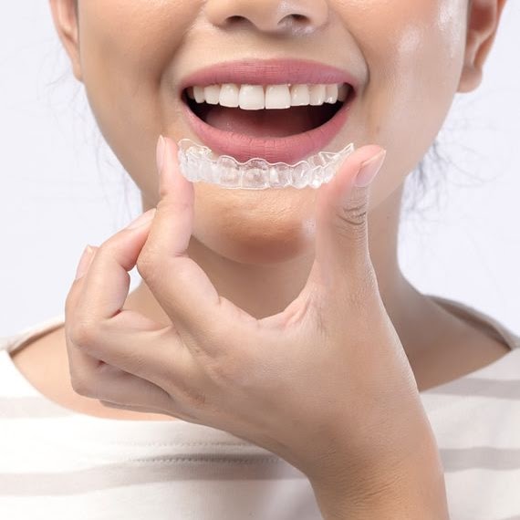 Clear Aligners